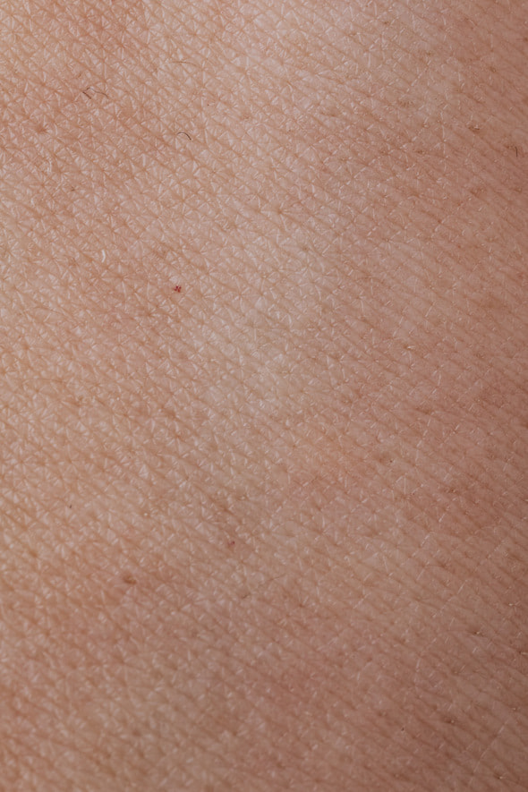 Human Skin texture. Skin texture worms. Skin texture bruised.